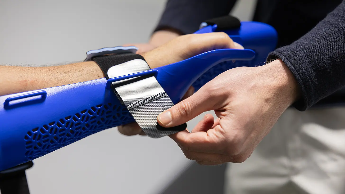 In der orthopädischen Werkstatt stellt ein Orthopädietechniker die Klettverschlüsse einer blauen Handorthese am Unterarm eines Patienten ein.