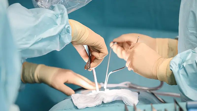 Chirurgischer Eingriff: Hände von medizinischem Personal während einer Operation am Rücken.