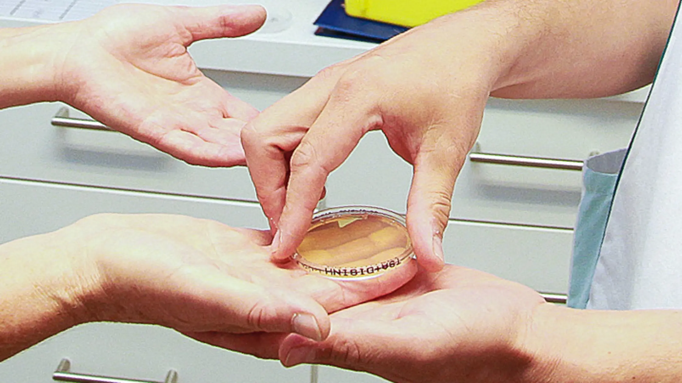 Eine Person entnimmt eine Probe aus einer Petrischale, die auf der geöffneten Hand einer anderen Person liegt, zur Kontrolle der Handhygiene.