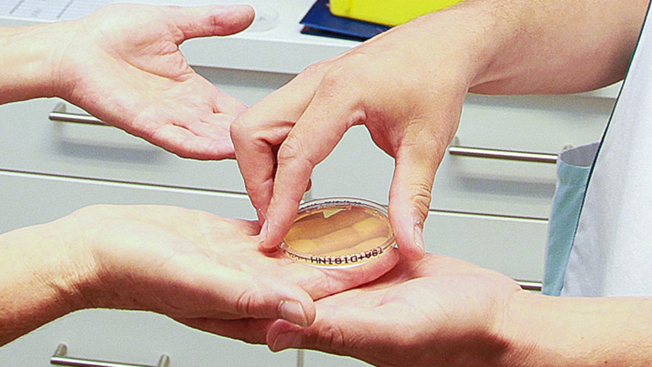 Eine Person entnimmt eine Probe aus einer Petrischale, die auf der geöffneten Hand einer anderen Person liegt, zur Kontrolle der Handhygiene.