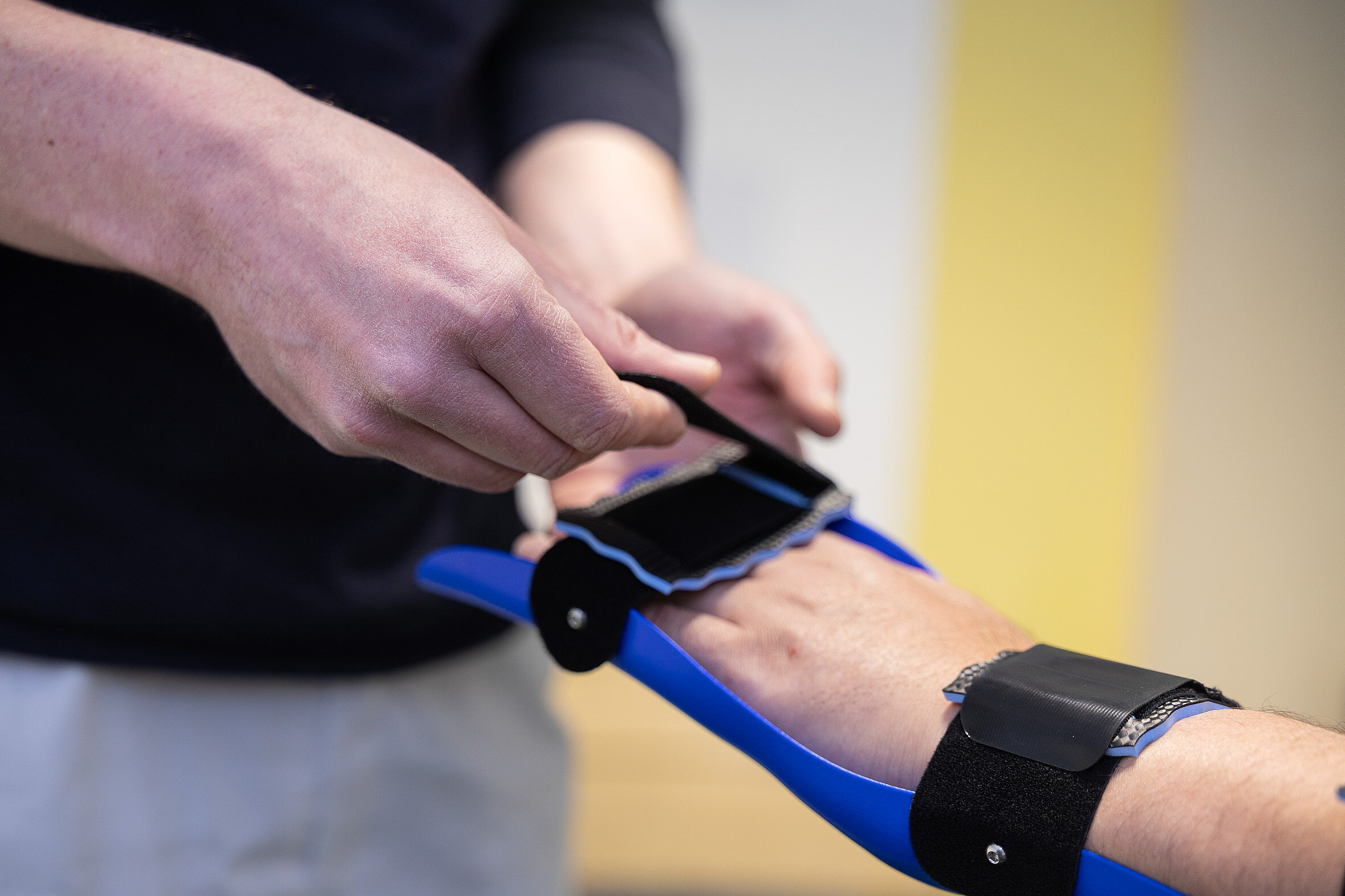 Nahaufnahme der Hände eines Orthopädietechnikers, der eine blaue Handorthese am Unterarm eines Patienten anpasst.