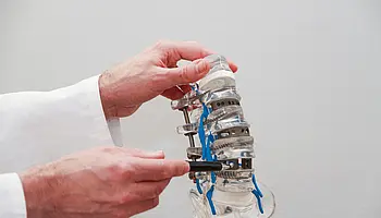 Detailaufnahme eines Wirbelsäulenmodells mit Schrauben und Stäben zur Stabilisierung.