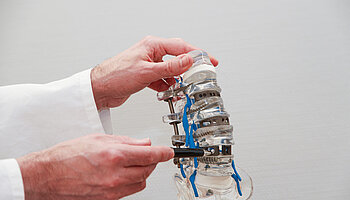 Detailaufnahme eines Wirbelsäulenmodells mit Schrauben und Stäben zur Stabilisierung.